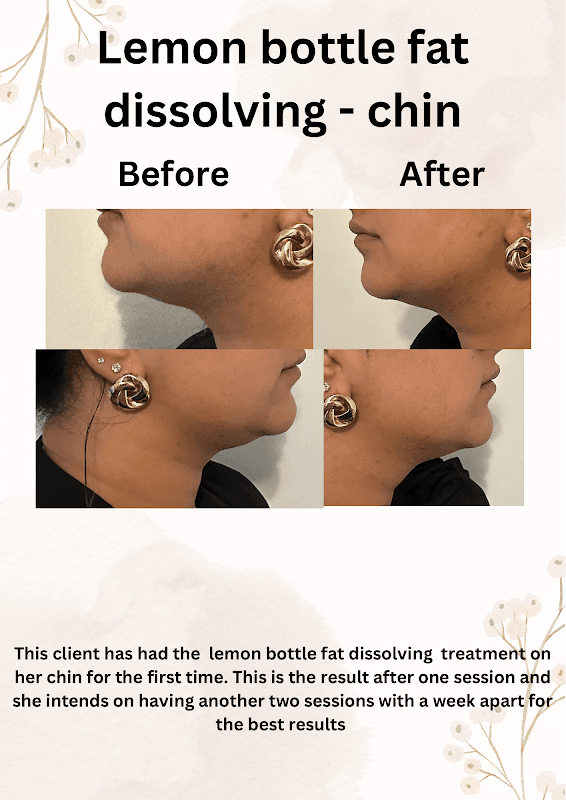 Luxe Beauty Clinic - Beauty Salons in batley