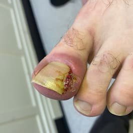 Podocare Podiatry and Chiropody Service - Doctors in bolsterstone ewden village