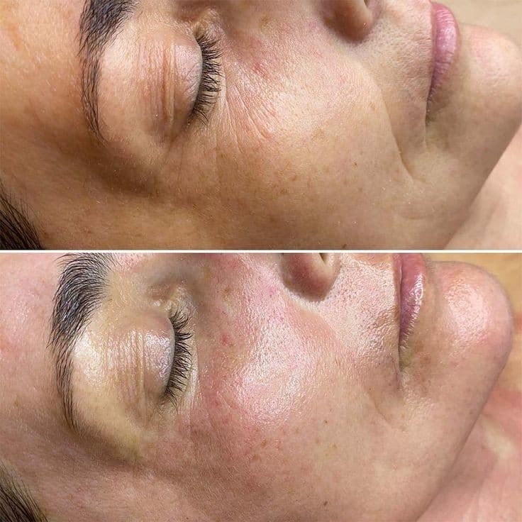 Angels Beauty Boutique - Beauty Salons in garforth