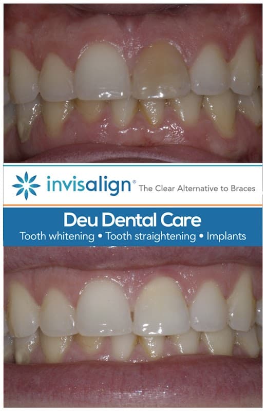 Deu Dental Care - Dentists in headingley