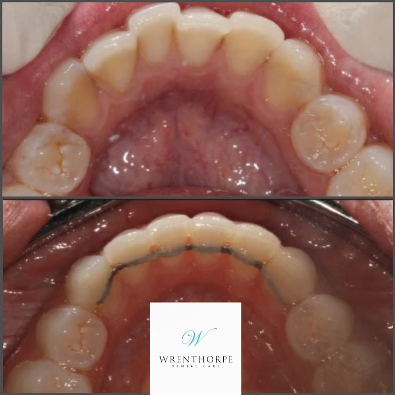 Wrenthorpe Dental Care - Dentists in wakefield